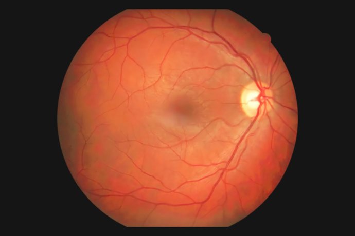 Archivo - Imagen de recurso de un ojo humano.