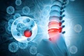 Foto: La Sociedad de Columna Vertebral advierte sobre las caídas como causa creciente de lesión medular en personas mayores