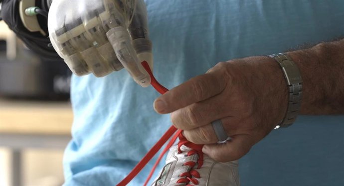 Imagen de la prótesis.