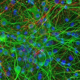 Cultivo 2D de células neuronales corticales (de cerebro): neuronas (verde) y células de glía (rojo). Laboratorio Facultad de Ciencias Biológicas UCM.