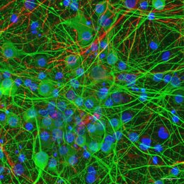 Cultura 2D de células neuronais corticais (cérebro): neurônios (verde) e células da glia (vermelho). Laboratório da Faculdade de Ciências Biológicas da UCM.