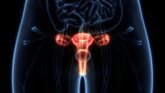Foto: Una ginecóloga oncológica subraya la importancia de las revisiones para una detección precoz del cáncer de ovario