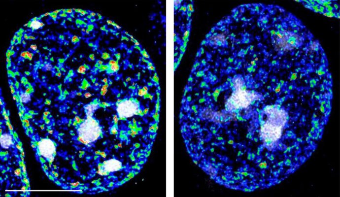 Núcleo de una neurona de un ratón control (izquierda) y de un ratón en el que se han eliminado las enzimas KDM1A y KDM5C. Se muestra la señal de ADN (gris) y una marca epigenética (en color) asociada a represión