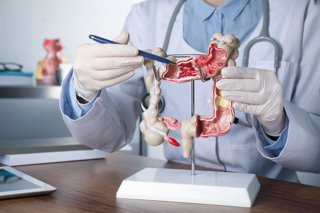 Archivo - Gastroenterólogo muestra el modelo de colon humano.