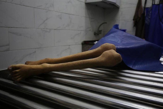 Cadáver de un palestino muerto por hambre en la Franja de Gaza a causa de la ofensiva de Israel y sus restricciones a la entrega de ayuda humanitaria a la población (archivo)