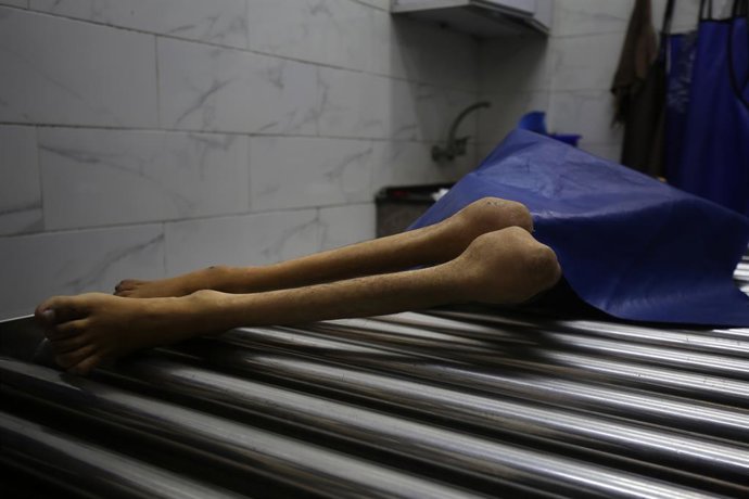 26 de agosto de 2025, Cidade de Gaza, Faixa de Gaza, Território Palestino: O corpo do palestino Hamada Nael Warsh Agha, de 28 anos, é levado ao Hospital Al-Shifa, na Cidade de Gaza, para os procedimentos funerários, depois que ele morreu de desnutrição ca