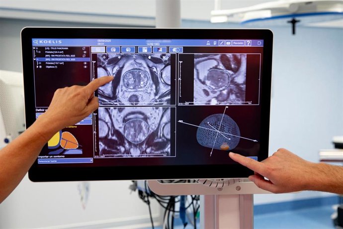 Imágenes del nuevo ecógrafo de Son Espases