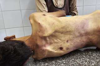 September 14, 2025, Dair El-Balah, Gaza Strip, Palestinian Territory: GRAPHIC CONTENT: Palestinians mourn the body of Mohammad Hussein Al-Sakhefi, who died from malnutrition at Al-Aqsa Martyrs Hospital in Deir al-Balah, central Gaza Strip, on September 14