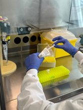 Foto: Desarrollan "el primer biomarcador en sangre" que anticipa la progresión hacia el Alzheimer