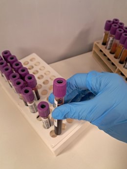 La Comunitat Valenciana cuenta con más de 43.500 donantes de médula ósea y cerca de 5.000 unidades de cordón umbilical