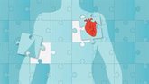 Foto: Cada hora mueren 13 personas en España, más de 150 al día, por una enfermedad cardiovascular