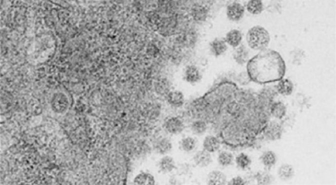 Virus del SARS-CoV-2 saliendo de las células infectadas .