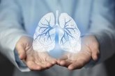 Foto: SEPAR insta a impulsar programas públicos de cribado nacional de cáncer de pulmón para reducir la mortalidad