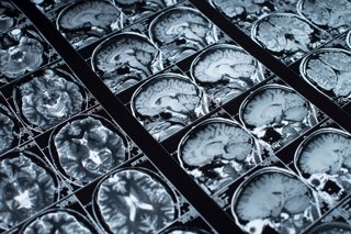 Archivo - Magnetic resonance  Resonancia magnetica