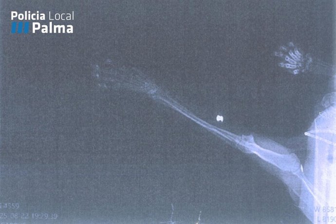 Investigado en Palma por disparar a un gato con una escopeta perdigones y dejarlo malherido.