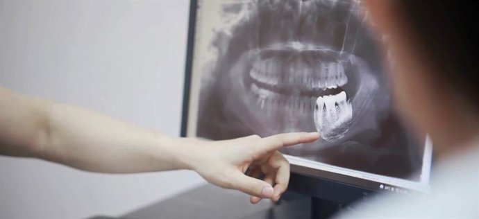Radiografía de una dentadura