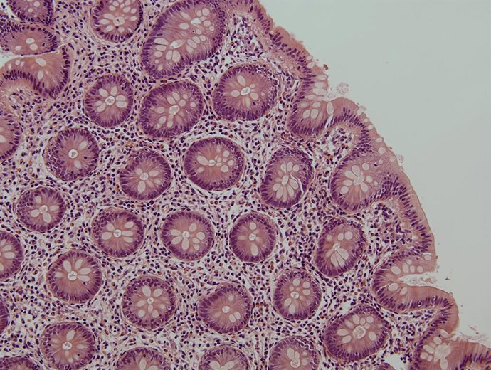 Archivo - Trabajo del IBiS en torno a nuevas estrategias para pacientes con VIH. Imagen de archivo.