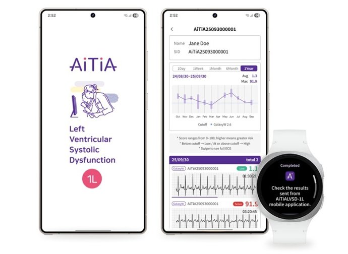 Monitoramento da disfunção sistólica do ventrículo esquerdo em um Galaxy Watch