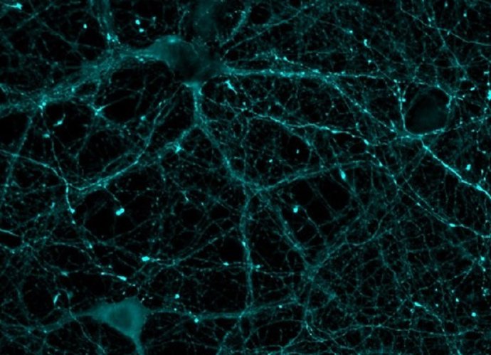 Imagen de microscopía con neuronas teñidas con marcadores estudiados en este trabajo. /