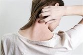 Foto: Empresas.- La FDA aprueba remubrutinib (Novartis) para el tratamiento oral contra la urticaria crónica espontánea