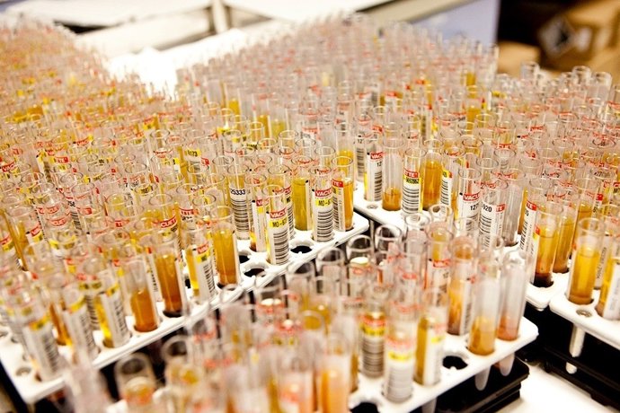 Imagen de recurso del Biobanco de Andalucía