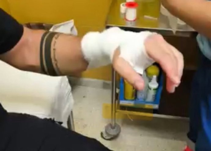 Agente de la Policía Local de Marchena herido en el altercado. Fotografía de las redes sociales de la policía del municipio.