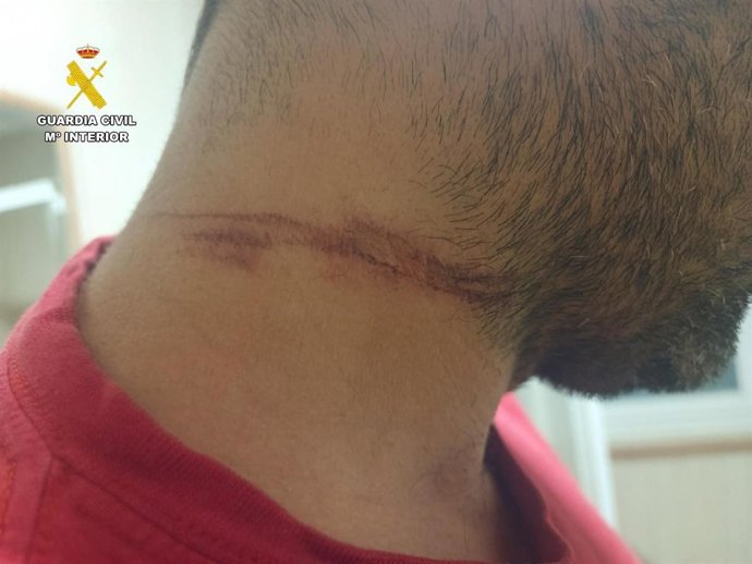 Herido por un pastor eléctrico.