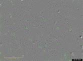 Foto: Investigadores españoles identifican un mecanismo bacteriano capaz de destruir células tumorales
