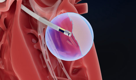 Comunicados Internacional