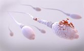 Foto: Esperanza para hombres con azoospermia: avances con ARNm y nanopartículas