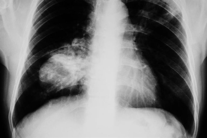 Archivo - En el trabajo han participado investigadores de la US y de los hospitales Macarena y Virgen del Rocío de Sevilla.