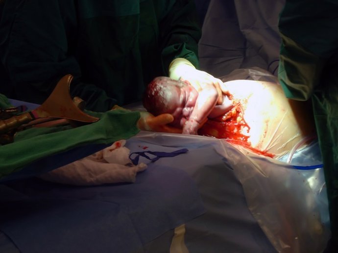 Archivo - C-section