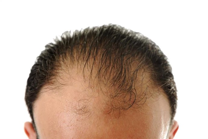 HairFluencer incorpora Evocapil como línea experta en el tratamiento integral de la caída del cabello