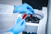 Foto: Un análisis genético de una muestra de sangre podría detectar el párkinson antes de los primeros síntomas