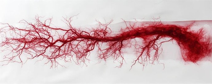 Imagem de arterite de células gigantes.
