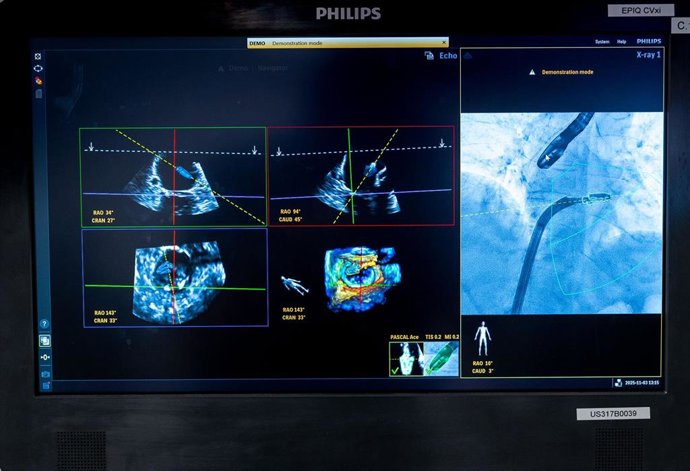 Dispositivo DeviceGuide de Philips.