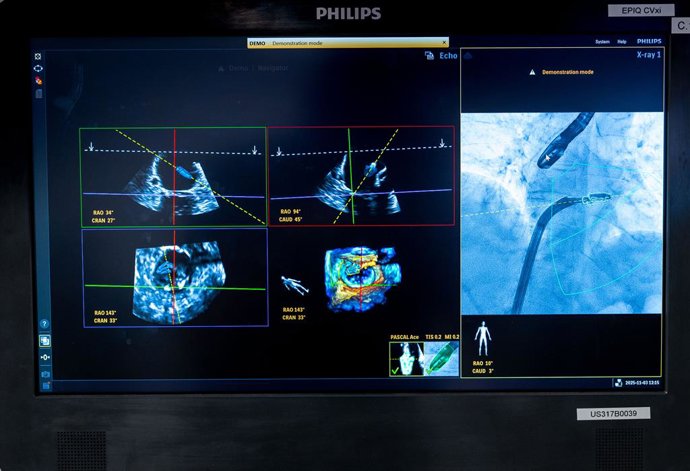 Dispositivo Philips DeviceGuide.