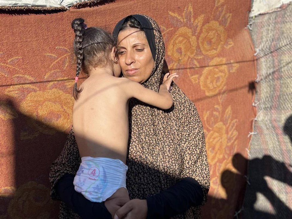 Archivo - Una niña palestina de cuatro años con desnutrición en el campamento de refugiados de Nuseirat, en la Franja de Gaza, en medio de la ofensiva de Israel contra el enclave costero (archivo)