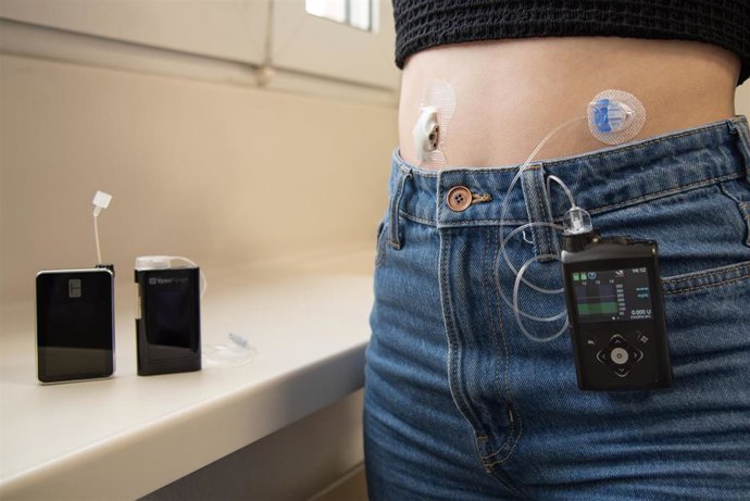 Modelos de sistemas integrados para la diabetes tipo 1 empleados actualmente en el SNS-O