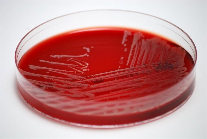 Archivo - Muestra de 'S. Aureus'