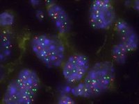 Capicua: la proteína que emerge como nueva diana para tumores pulmonares con mutaciones KRAS y TP53