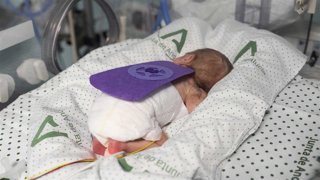 Imagen de un bebé prematuro ingresado en el Hospital Juan Ramón Jiménez de Huelva.