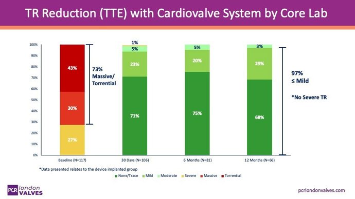 TR Reduction (TTE) with Cardiovalve System by Core Lab
