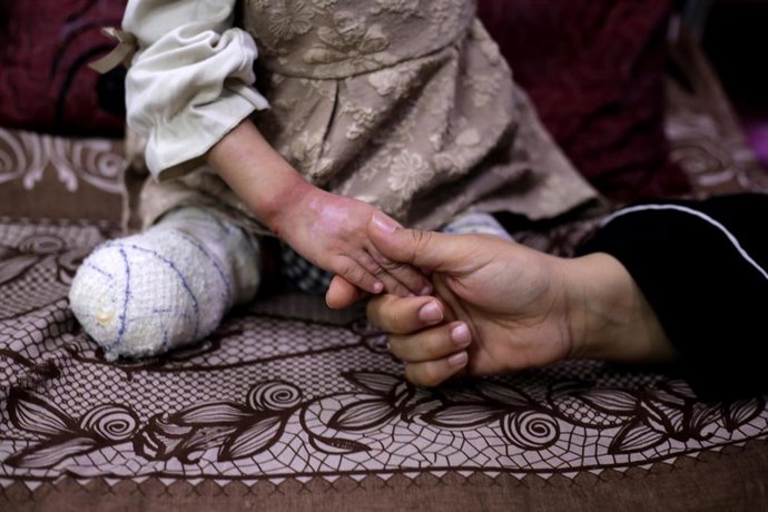 Archivo - Un niño amputado en el Hospital Mártires de Al Aqsa, en la ciudad de Deir al Balá, a causa de la ofensiva lanzada por Israel contra la Franja de Gaza tras los ataques del 7 de octubre de 2023 (archivo)