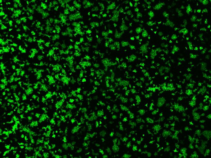 Imagen de microscopio de células fusionadas tras expresar la proteína spike del coronavirus porcino PHEV y de su receptor (DPEP1)./