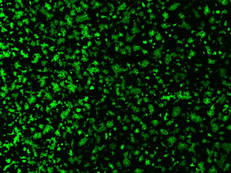 Imagen de microscopio de células fusionadas tras expresar la proteína spike del coronavirus porcino PHEV y de su receptor (DPEP1)./