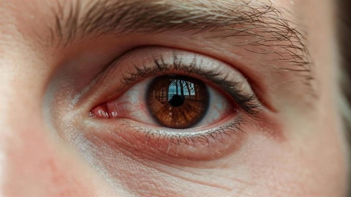 Imagen de recurso ojo seco.