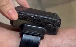 Tobillera de Jair Bolsonaro dañada por un soldador