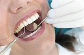 Foto: Entre el 30% y el 50% de los casos de hipertensión arterial o diabetes podrían detectarse en las consultas dentales