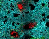 Foto: Publican 'NeuMap', el primer atlas que redefine el papel de los neutrófilos en la salud e infección